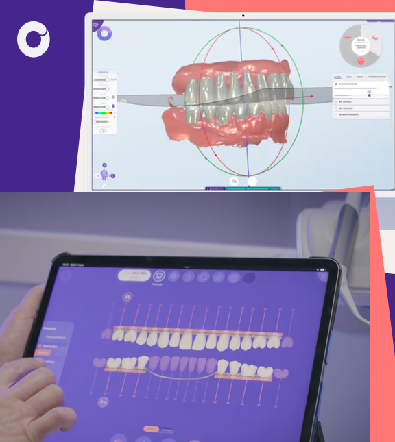 Interfaces Circle Dental montrant une dentition en 3D et un flux de travail sur tablette